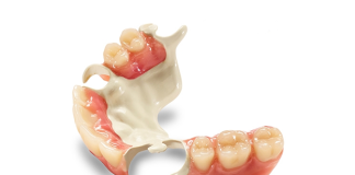 Important Considerations about Wearing Dentures