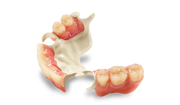 Important Considerations about Wearing Dentures